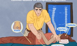 Chatswood Chiropractors and Sports: Enhancing Performance and Preventing Injuries