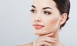 The Ultimate Guide to Buccal Fat Removal