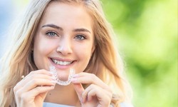 An Ultimate Guide About Removable Retainers or Clear Aligners
