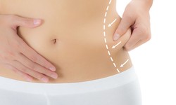 The Body Canvas: Liposuction Your Way to Beauty