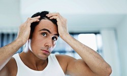 Things to Look For In the Best Hair Loss Treatment London Clinic