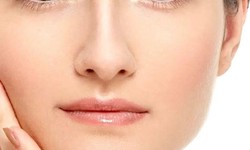 Cost-Effective Beauty-Unveiling the Price-Performance Balance at Kane Medical Aesthetics for Botox Procedures