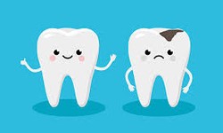 Understanding Common Dental Issues