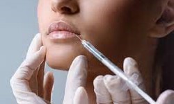 Lip Perfection Unleashed-Kane Institute's Latest Techniques in Filler Artistry
