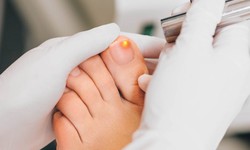 Exploring the Transformative Potential of Nail Fungus Laser Therapy
