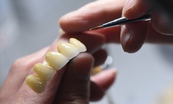 Revolutionizing Dentistry: The Cutting-Edge Solutions of China Digital Dental Labs