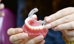 Dentures Unveiled: Transforming Lives in Glenview's Dental Scene