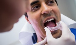 Transforming Smiles: A Deep Dive into Invisalign Treatment at DenCare Clinic