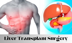 Navigating the Seas of Liver Transplant Surgery: A Holistic Guide for Patients