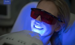 Painless Teeth Whitening: Brighten Your Smile with Everbrite