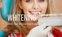 A Complete Guide to Understand Teeth Whitening: Tips and Techniques