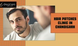 Your Ultimate Solution for Hair Replacement, Wigs, Extensions, and Patches in Chandigarh and Mohali