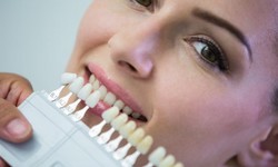 Enhancing Your Smile: The Art of Dental Veneers in Essex