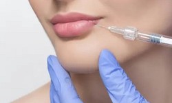 Refining Beauty: The Artistry of Lip Reduction Treatment