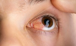 Diabetic Eye Disease: Protecting Your Vision When You Have Diabetes