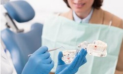 Rebuilding Smiles: A Comprehensive Guide to Bone Grafting for Teeth