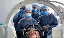 Exploring the Depths of Deep Brain Stimulation Surgery