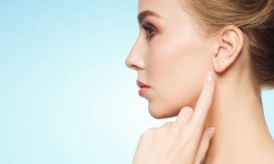 Understanding Ear Reshaping Surgery