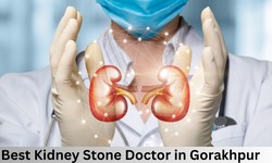 Dr. Prashant Mohan Singh: Transformative Homeopathic Solutions for Kidney Stones in Gorakhpur