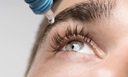 Careprost Eyelash Serum: The Secret Remedies For Eyelash Grow