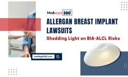 Allergan Breast Implant Lawsuits: The Reality