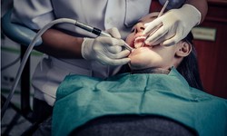 Dental Excellence in the Heart of Rockwall: Your Guide to Top Dentists