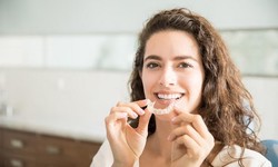 A Comprehensive Guide to Dental Implants: Everything You Need to Know