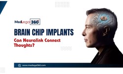 Brain Chip Implants: An Analysis of Potential and Pitfalls