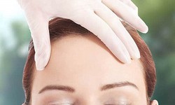 Addressing Drooping Eyebrows Through Forehead Lift Surgery