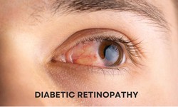 Diabetic Retinopathy: Safeguard Your Vision with Advanced Therapies
