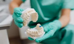 The Top 10 Best Dentures in Montreal at Galerie Dentaire Soleil