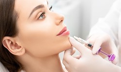 What are the Best Techniques for Lip Augmentation