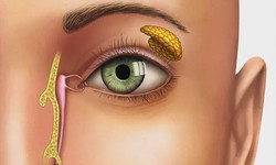 Delivering Excellence in Squint Eye Treatment in NCR