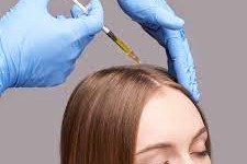 Experience the Miracle of PRP Hair Regeneration