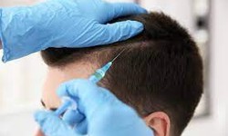 What is the difference between FUE and FUT hair transplant methods?