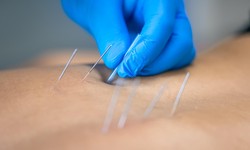 Outsourcing Acupuncture Billing: Ensuring Compliance and Accuracy