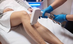 Top Picks: The Best Laser Hair Removal Clinic Abu Dhabi