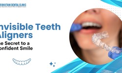 Invisible Teeth Aligners The Secret to a Confident Smile