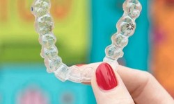 Learn How to Maintain Your Invisalign San Diego Aligners @ Mesadentalsd