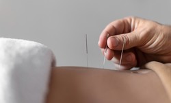 The Essential Guide to Acupuncture Billing Services