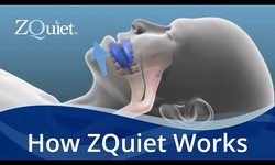 Silent Nights Await: The Power of ZQuiet Mouthpiece in Banishing Snores