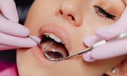 How to Prepare for Wisdom Teeth Removal ?
