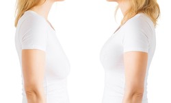 Breast Augmentation–Types of Breast Implants
