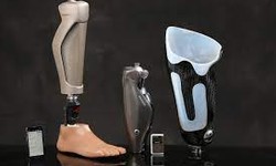 Bionic India: Empowering Lives with Advanced Lower Extremity Prosthetic Solutions