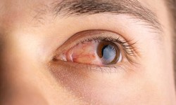 Best retina eye laser treatment for retina eye surgery in NCR
