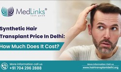 Synthetic Hair Transplant Price In Delhi - Medlinks