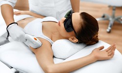 Unmask the Secret to Smooth Skin: Laser Hair Removal Tampa