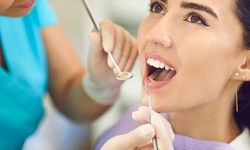 Transform Your Smile with the Best Dental Cleaning Services in Montreal