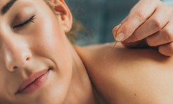 Exploring the Connection: Acupuncture and Better Sleep