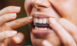 Unveiling the Best Portland Teeth Whitening Services for a Dazzling Smile
